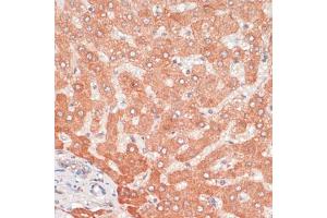 Immunohistochemistry of paraffin-embedded human liver using  antibody (ABIN6131192, ABIN6137264, ABIN6137265 and ABIN6215207) at dilution of 1:100 (40x lens). (ATG5 Antikörper  (AA 28-275))