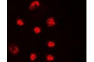 Immunofluorescent analysis of Lupus La (pS366) staining in HeLa cells. (Lupus La (C-Term), (pSer366) Antikörper)