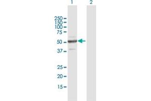 Western Blot analysis of ZNF772 expression in transfected 293T cell line by ZNF772 MaxPab polyclonal antibody. (ZNF772 Antikörper  (AA 1-489))