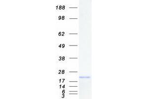 Western Blotting (WB) image for Fast Skeletal Troponin C (TNNC2) protein (Myc-DYKDDDDK Tag) (ABIN2732106)
