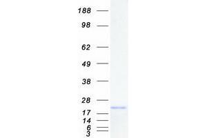 Validation with Western Blot (TNNC2 Protein (Myc-DYKDDDDK Tag))