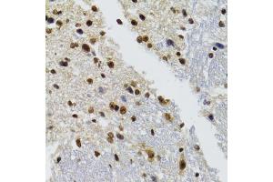 Immunohistochemistry of paraffin-embedded mouse brain using BAZ1B antibody. (BAZ1B Antikörper)