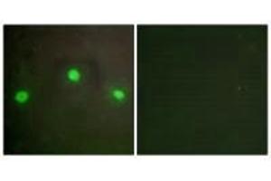 Immunofluorescence analysis of A549 cells, using ATRX antibody. (ATRX Antikörper  (N-Term))