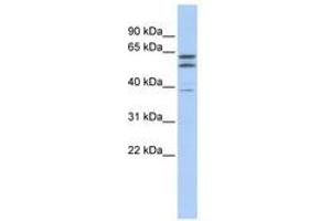 Image no. 1 for anti-Tubulin, beta 2A (TUBB2A) (N-Term) antibody (ABIN6740656)