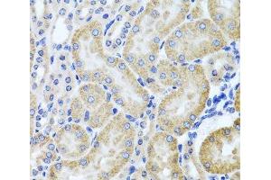 Immunohistochemistry of paraffin-embedded Mouse kidney using HDAC6 Polyclonal Antibody at dilution of 1:100 (40x lens). (HDAC6 Antikörper)
