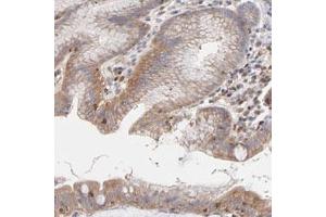 Immunohistochemical staining (Formalin-fixed paraffin-embedded sections) of human stomach with ARHGEF6 polyclonal antibody  shows cytoplasmic and membranous positivity in glandular cells. (ARHGEF6 Antikörper)