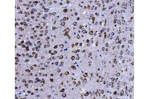 IHC analysis of EIF3A using anti-EIF3A antibody (ABIN7599942).