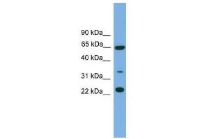 Western Blot showing TRAPPC5 antibody used at a concentration of 1-2 ug/ml to detect its target protein. (TRAPPC5 Antikörper  (N-Term))