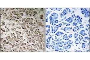 Immunohistochemistry (IHC) image for anti-NADH Dehydrogenase (Ubiquinone) 1 beta Subcomplex, 1, 7kDa (NDUFB1) (AA 7-56) antibody (ABIN1535060)