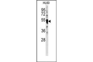 Image no. 1 for anti-Interferon Regulatory Factor 8 (IRF8) (C-Term) antibody (ABIN357999) (IRF8 Antikörper  (C-Term))
