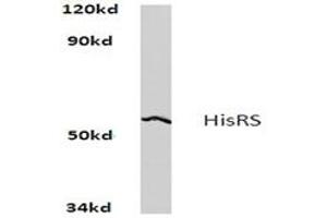 Image no. 1 for anti-Histidyl-tRNA Synthetase (HARS1) antibody (ABIN272164) (HARS1/Jo-1 Antikörper)