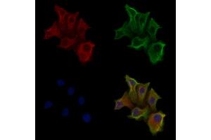ABIN6258162 and ABIN6275961 staining Hela cells by IF/ICC.