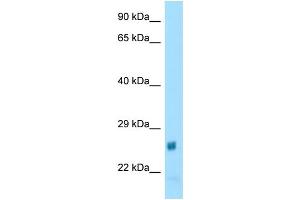WB Suggested Anti-Naa60 Antibody Titration: 1. (NAT15 Antikörper  (N-Term))
