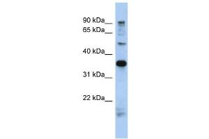 MGC70924 antibody used at 1 ug/ml to detect target protein. (PRR19 Antikörper  (N-Term))