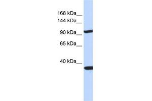 WB Suggested Anti-PAPPA2 Antibody Titration:  0. (PAPPA2 Antikörper  (N-Term))