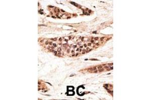 Immunohistochemistry (Paraffin-embedded Sections) (IHC (p)) image for anti-Transporter 1, ATP-Binding Cassette, Sub-Family B (MDR/TAP) (TAP1) (AA 765-794), (C-Term) antibody (ABIN390185)