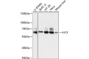 Western blot analysis of extracts of various cell lines, using CF antibody (3087) at 1:3000 dilution. (A1CF Antikörper  (AA 50-120))