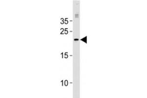 MGMT antibody western blot analysis in MCF-7 lysate. (MGMT Antikörper  (AA 1-30))