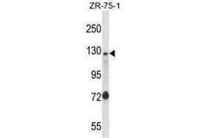UBE4A Antibody (Center) western blot analysis in ZR-75-1 cell line lysates (35 µg/lane). (UBE4A Antikörper  (Middle Region))