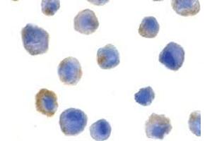 Immunocytochemistry of FLIP in HeLa cells with AP30341PU-N FLIP antibody at 5 μg/ml.