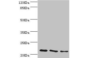 Western blot All lanes: TAGLN2 antibody at 4. (TAGLN2 Antikörper  (AA 1-199))