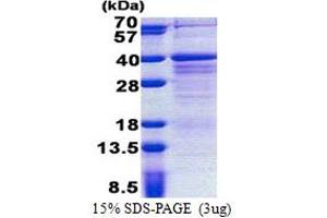 SDS-PAGE (SDS) image for Zinc Finger, Matrin-Type 3 (ZMAT3) (AA 1-289) protein (His tag) (ABIN6387258) (ZMAT3 Protein (AA 1-289) (His tag))