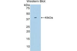 Western Blotting (WB) image for anti-Single Immunoglobulin and Toll-Interleukin 1 Receptor (TIR) Domain (SIGIRR) (AA 1-117) antibody (ABIN7437836)
