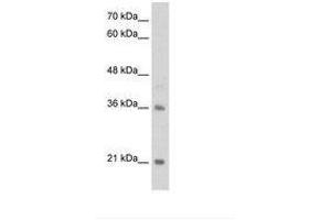 Image no. 1 for anti-Transcription Factor 15 (Basic Helix-Loop-Helix) (TCF15) (N-Term) antibody (ABIN203295) (TCF15 Antikörper  (N-Term))