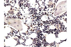 Formalin-fixed and paraffin embedded rat articular cartilage labeled with Anti-MMP-13 Polyclonal Antibody (ABIN670341), Unconjugated at 1:200, followed by conjugation to the secondary antibody and DAB staining (MMP13 Antikörper  (AA 201-300))