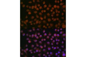 Immunofluorescence analysis of HeLa cells using Emerin/EMD Rabbit mAb (ABIN7266933) at dilution of 1:100 (40x lens). (Emerin Antikörper)