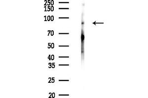 anti-Guanylyl Cyclase alpha 2 (N-Term) antibody