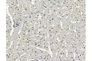 ABIN7097060 and ABIN7101127 at 1/100 staining rat heart tissue by IHC-P.