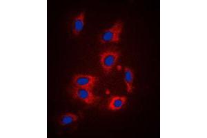 Immunofluorescent analysis of PAR1 staining in HeLa cells. (PAR1 Antikörper  (N-Term))