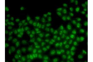 Immunofluorescence (IF) image for anti-Inhibitor of DNA Binding 3, Dominant Negative Helix-Loop-Helix Protein (ID3) (AA 1-119) antibody (ABIN6142140)