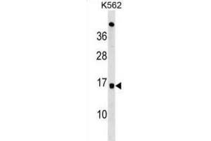 Western Blotting (WB) image for anti-Ubiquitin-Conjugating Enzyme E2D 4 (UBE2D4) antibody (ABIN3000670) (UBE2D4 Antikörper)