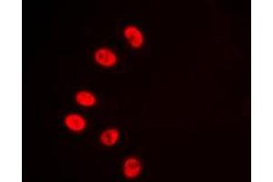 Immunofluorescent analysis of NR2F6 staining in HepG2 cells. (NR2F6 Antikörper  (N-Term))