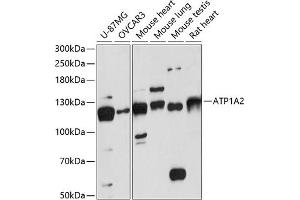Western blot analysis of extracts of various cell lines, using  antibody (ABIN6129199, ABIN6137302, ABIN6137303 and ABIN6217930) at 1:3000 dilution. (ATP1A2 Antikörper  (AA 1-70))