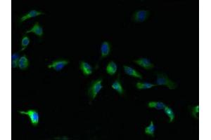 Immunofluorescent analysis of U251 cells using ABIN7165738 at dilution of 1:100 and Alexa Fluor 488-congugated AffiniPure Goat Anti-Rabbit IgG(H+L) (TMBIM1 Antikörper  (AA 1-109))