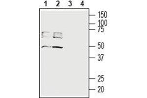 Western blot analysis of rat (lanes 1 and 3) and mouse (lanes 2 and 4) brain lysates: - 1,2. (SLC16A3 Antikörper  (C-Term, Intracellular))