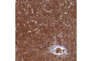 Immunohistochemical staining of human liver with NUDT16L1 polyclonal antibody  shows strong cytoplasmic positivity in hepatocytes at 1:200-1:500 dilution.