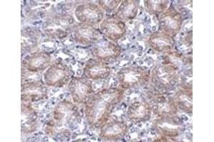 Immunohistochemistry (IHC) image for anti-Mitochondrial Carrier 2 (MTCH2) (N-Term) antibody (ABIN1031463) (MTCH2 Antikörper  (N-Term))