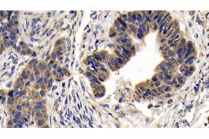 Immunohistochemistry (IHC) image for anti-BCL2-Like 1 (BCL2L1) (AA 2-212) antibody (ABIN7437179)