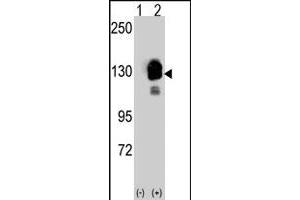 Western blot analysis of CDH8 (arrow) using rabbit CDH8 polyclonal antibody . (Cadherin 8 Antikörper  (N-Term))