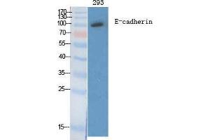 Western Blotting (WB) image for anti-Cadherin 1, Type 1, E-Cadherin (Epithelial) (CDH1) (C-Term) antibody (ABIN3184389) (E-cadherin Antikörper  (C-Term))