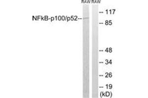 Western blot analysis of extracts from RAW264. (NFKB2 Antikörper  (AA 836-885))