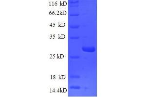 SDS-PAGE (SDS) image for Nidogen 1 (NID1) (AA 428-665) protein (His tag) (ABIN5710011) (Nidogen 1 Protein (NID1) (AA 428-665) (His tag))