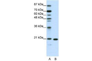 WB Suggested Anti-RPL9  Antibody Titration: 1. (RPL9 Antikörper  (C-Term))
