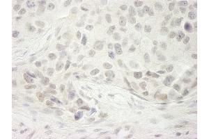 anti-DEAH (Asp-Glu-Ala-His) Box Polypeptide 33 (DHX33) (AA 1-50) antibody