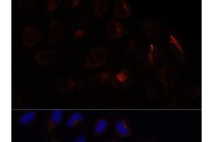 Immunofluorescence analysis of U-2 OS cells using CHP1 Polyclonal Antibody at dilution of 1:100. (CHP Antikörper)