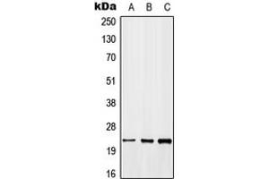 Western blot analysis of GADD45 beta expression in MCF7 (A), NIH3T3 (B), H9C2 (C) whole cell lysates.